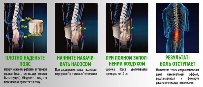 Фото 4. Корсет для спины и поясницы NEW Spinal Doctor 101при остеохондрозе, сколиозе, грыже