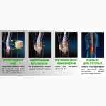 Корсет для спины и поясницы NEW Spinal Doctor 101при остеохондрозе, сколиозе, грыже