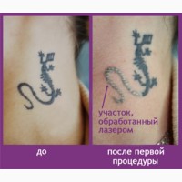 Перманентный макияж, татуаж, татуировки в технике 3D, удаление тату, услуги косметолога