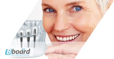 Стоматолог - Ортодонт. Все виды брекетов. Выравнивание зубов
