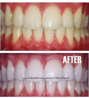 Фото 3. Экспресс быстрое отбеливание зубов Crest 3D White Whitestrips 1 Hour Expess - USA