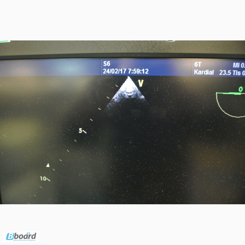 Фото 8. Ультразвуковой аппарат GE Vivid S6 с четырьмя датчиками 2012г
