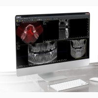 Конусно-лучевой томограф Owandy I-Max 3D
