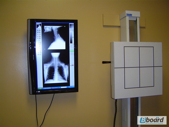 Цифровой ССD приемник рентген графического изображения, новый
